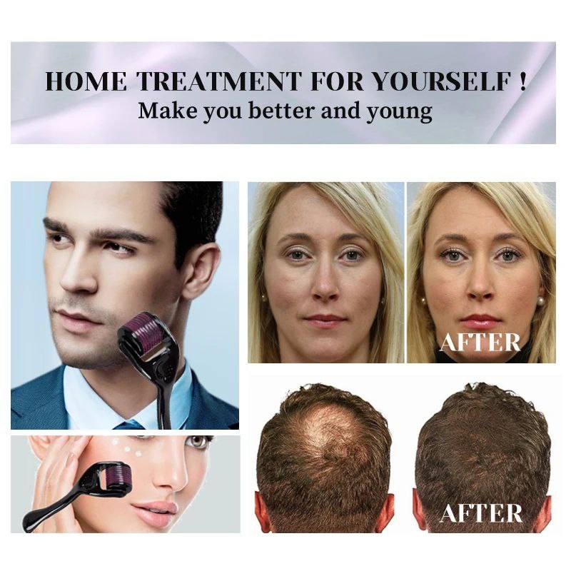 Rodillo Dermatologico para Piel