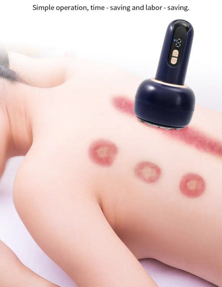 Masajeador de terapia de ventosas 9 velocidades