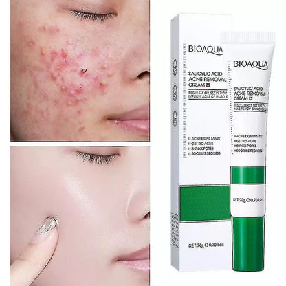 Crema Acido Salicilico Antimperfeccione