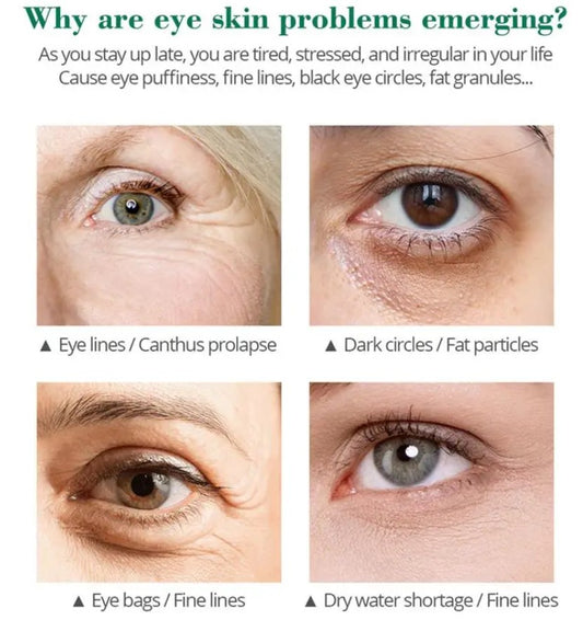 Serum anti arruga de Aguacate