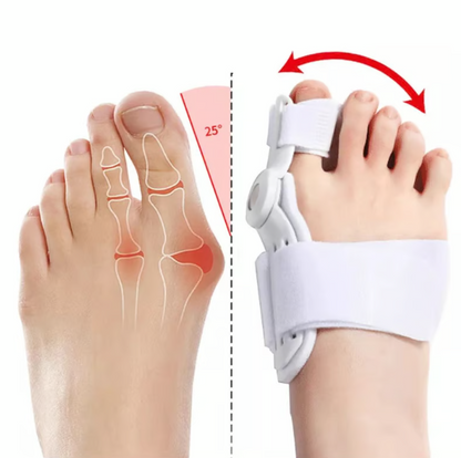 Corrector de juanetes