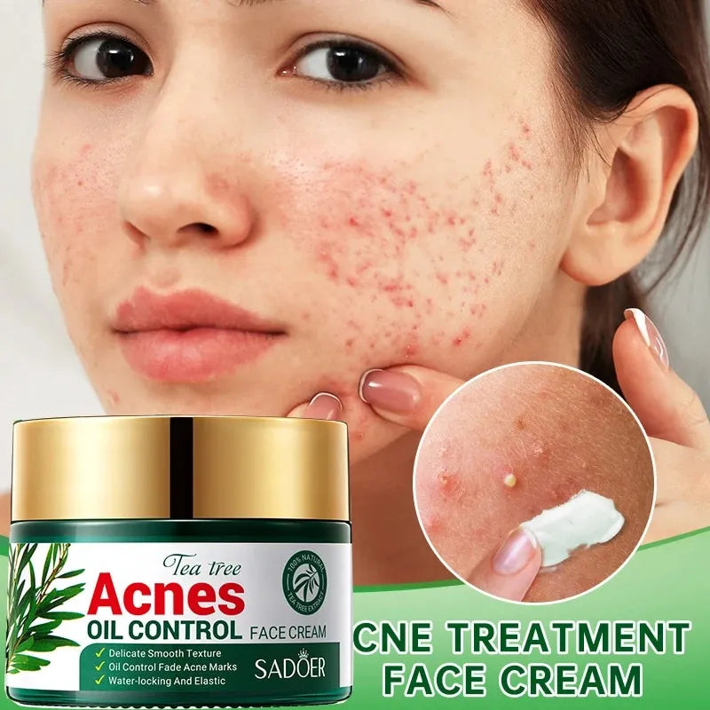 Crema Facial Acnes