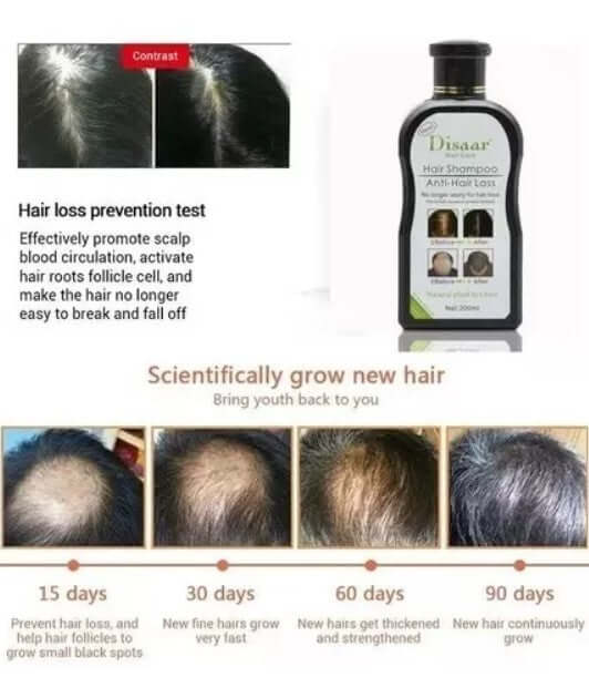 shampoo anticaída fortalece el cabello
