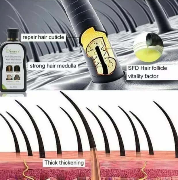 shampoo anticaída fórmula natural