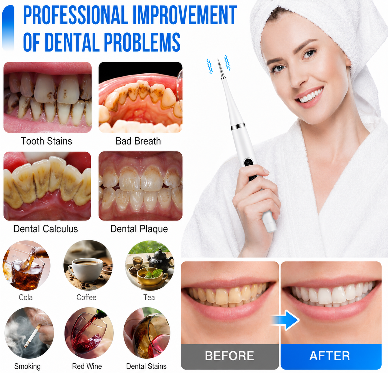Removedor de Sarro Dental