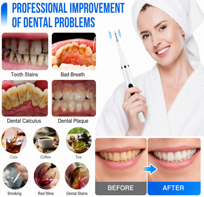 Removedor de Sarro Dental