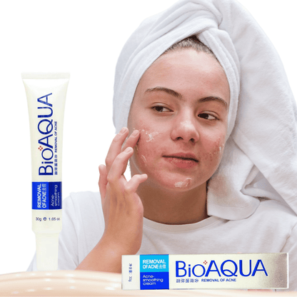 CREMA PARA ACNÉ BIOAQUA