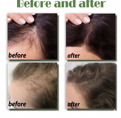 Aceite, serum crecimiento de cabello