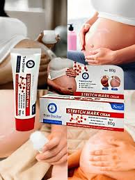 Crema para reparar y reducir estrias